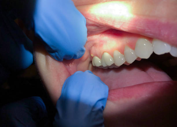 Professional Emergency Dental Service in CT